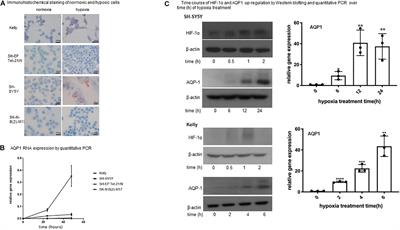 AQP1 Is Up-Regulated by Hypoxia and Leads to Increased Cell Water Permeability, Motility, and Migration in Neuroblastoma